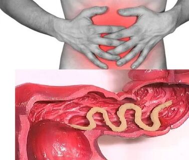 Človeški zajedavci