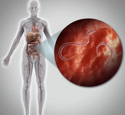 Zajedavci v človeškem telesu