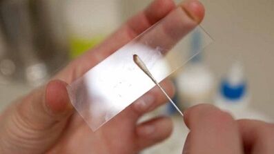 Analiza Calais za identifikacijo zajedavcev