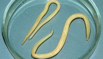 Kako pravilno opraviti teste za asariazo