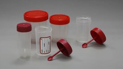 kako se pripraviti na test zajedavcev