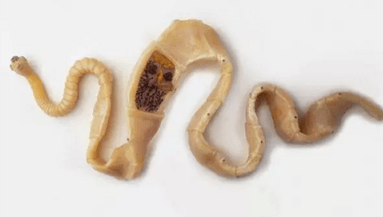 Kako odkriti prisotnost parazitov v telesu