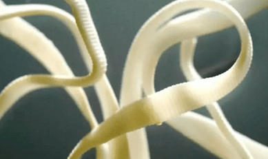 kako odstraniti parazite iz človeškega telesa